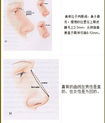 隆鼻手術(shù)介紹